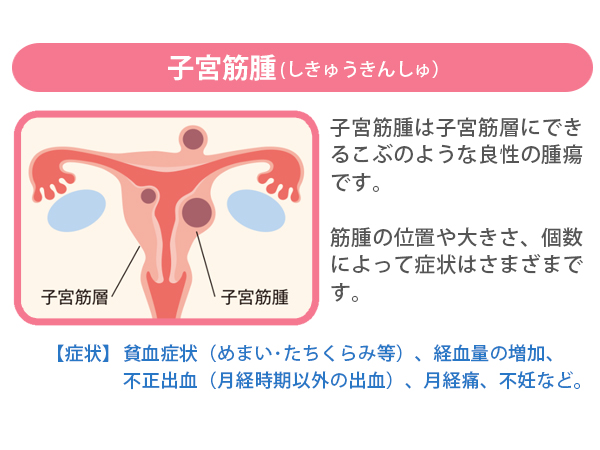 関西ウーマン