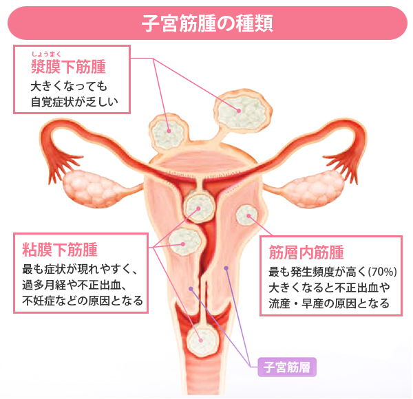 関西ウーマン